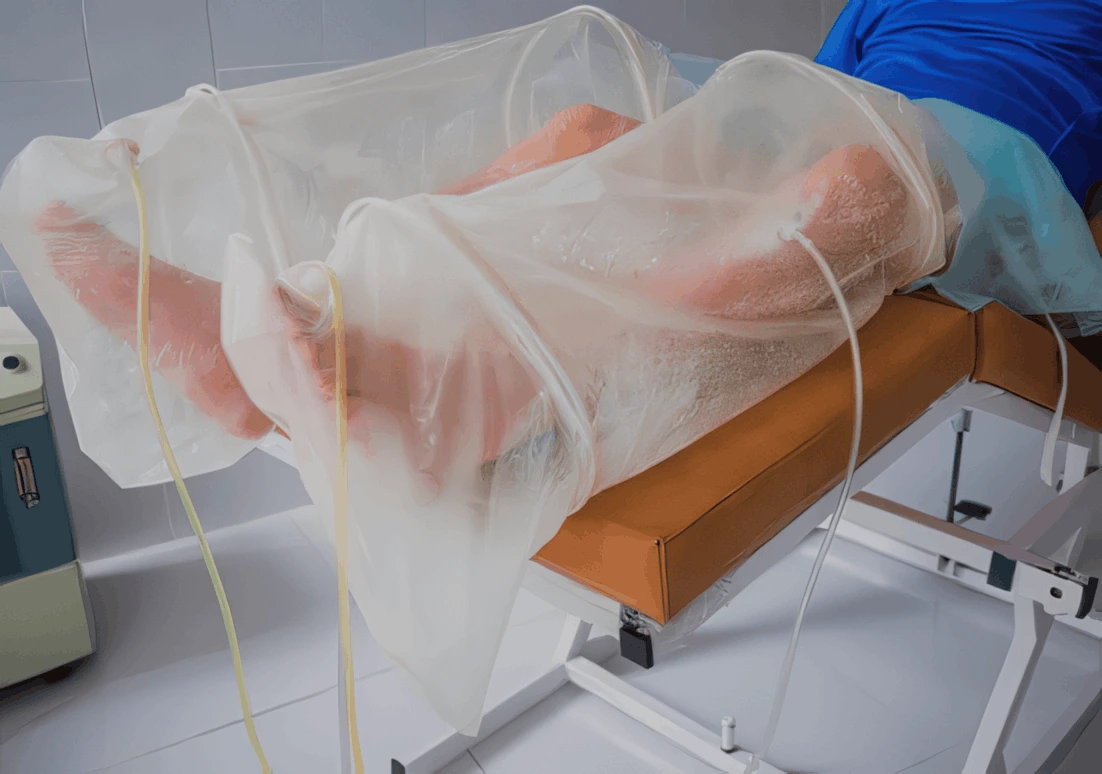 Equipamento e materiais para atendimento de ozonioterapia